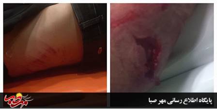 تلاش ۵ ساعته کارشناسان فوریت های پزشکی میانه برای نجات جوان ۳۵ ساله